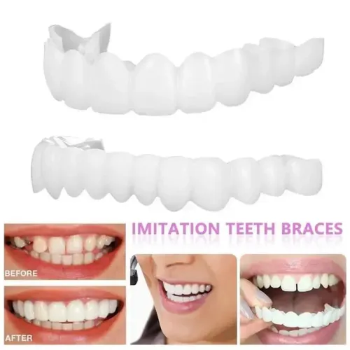 Adult Adjustable Dentures Teeth Set Adjustable Snap-on Fake Teeth Portable Braces Decorate Gaps For Teeth Enhance Aesthetic