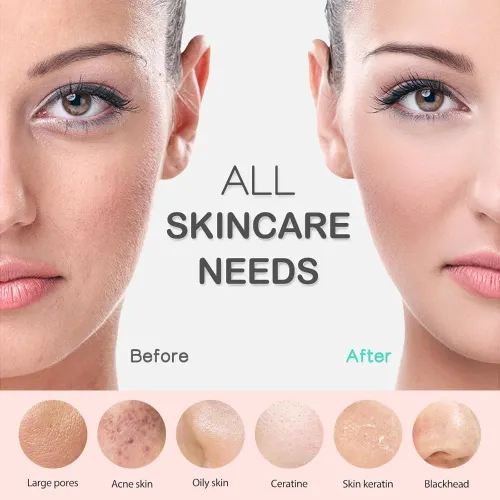 Silicone Face Scrubber, Rechargeable Facial Cleansing Brush with Heat Massage And, Waterproof Face Brush for Women and Men Green