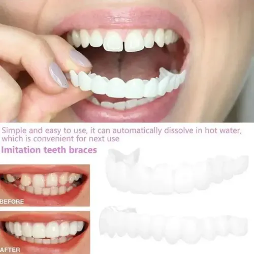 Adult Adjustable Dentures Teeth Set Adjustable Snap-on Fake Teeth Portable Braces Decorate Gaps For Teeth Enhance Aesthetic