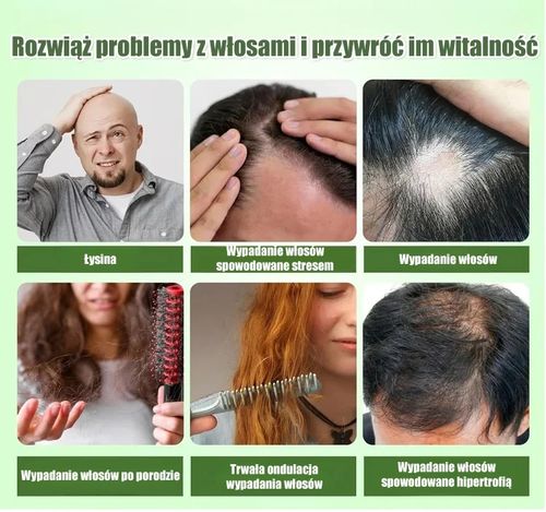 Shampoo with herbal extract – The less hair you have, the better the effect.