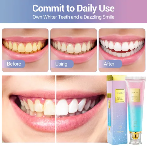 Whitening Toothpaste