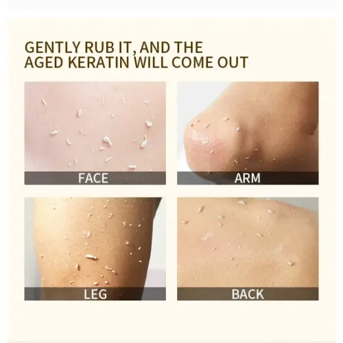 Orange Exfoliating Gel Exfoliation, Dead, Removal Deeply Cleansing, Long-Lasting,Moisture Cleanses Pores,Safe for Full Body