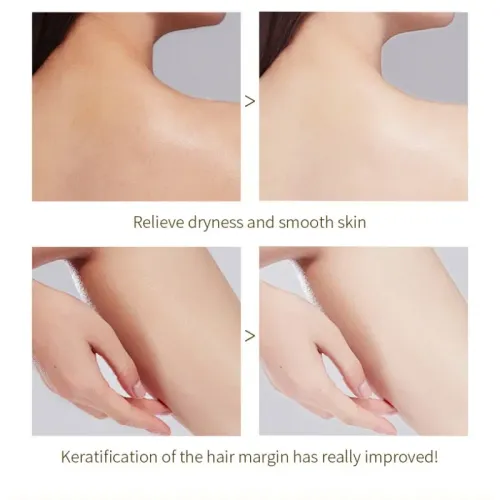 Orange Exfoliating Gel Exfoliation, Dead, Removal Deeply Cleansing, Long-Lasting,Moisture Cleanses Pores,Safe for Full Body