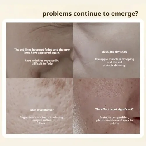 Anti Wrinkle Face Cream Polypeptide Firms Skin Texture & Lightens Fine Lines Rejuvenating Repair For Morning Night