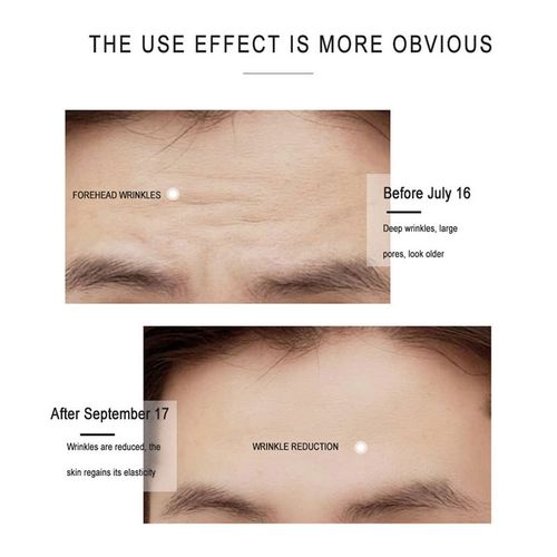 NowNoon Anti-Wrinkle Cream