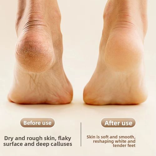 3 In 1 Electric Foot Grinder Foot Care Device Rechargeable Pedicure Machine Removes Dry Skin For Smoother Feet Pedicure Tools