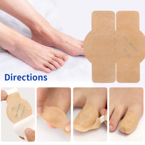 21pcs Waterproof Nail Fungus Patch Ingrown Toenail Correction Sticker Damaged Gray Nail Repair Care Feet Tools