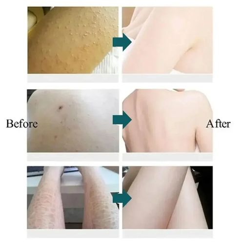 3PCS Beauty Product Herbal Anti Crack Foot Cream Heel Cracking Repair Products Exfoliation Dead Skin Removal Softening Moisturize