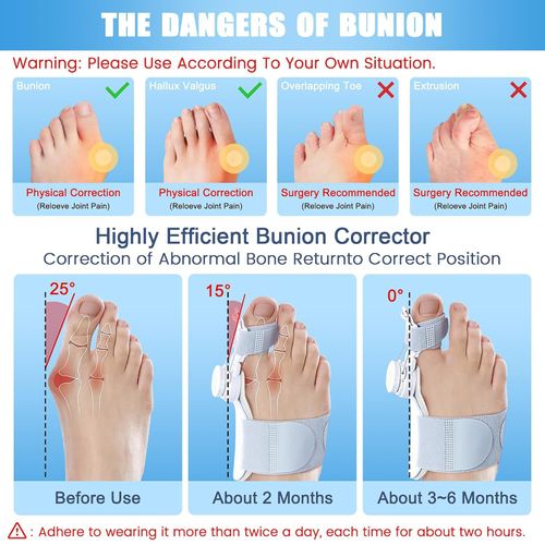 Bunion Corrector for Women & Men, Adjustable Knob Bunion Brace Splint for Big Toe Relief Bunion Splints Hammer Toe Straightener Suitable for Left and Right Feet, with 1 Pair Toe Seperator