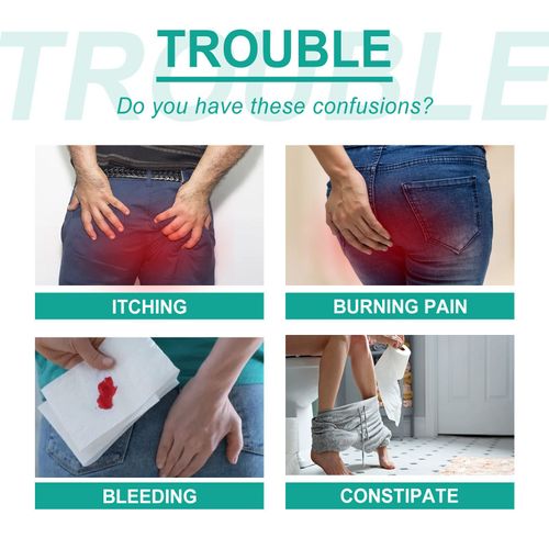 Perianal Savior,Ximonth Hemorrhoid Elimination Cream, a herbal formula that gently treats hemorrhoids, quickly alleviates redness, swelling, pain and itching. Order today and get 2 tubes for a full course of treatment. It directly targets the root cause of hemorrhoids and also moisturizes the perianal area. Say goodbye to the pain of hemorrhoids and regain a carefree life. Don't miss out on this great offer!