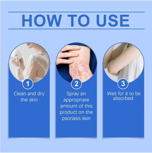 Magnesium Herbal Psoriasis Repair Spray, featuring a natural formula of ginger and ginseng. It is gentle and non-irritating even when applied to sensitive reddened areas. Spray onto the skin, and within 10 minutes, the itching will subside and the skin barrier will be repaired. Spray on tense shoulders and necks, and gently massage to relieve the stiffness caused by acid. Order today and you'll receive 2 bottles, covering your soothing needs for the entire month.