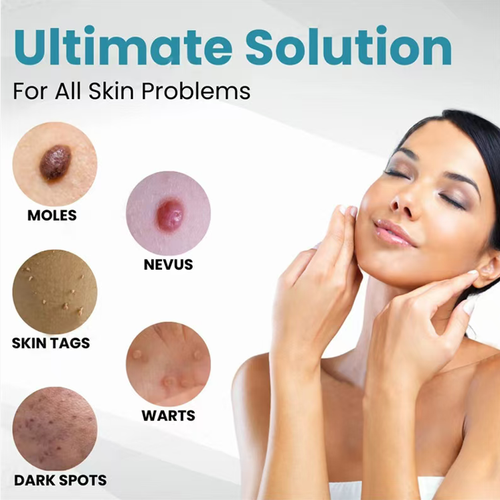 The ultrasonic laser wart removal pen is equipped with 30 years of clinical carbon dioxide laser technology. It can precisely remove moles, warts and skin blemishes, and alleviate the symptoms of rosacea within one week. The pen is small and portable, and can be operated with just one button. It enables you to easily handle various skin blemishes at home, and is gentle and non-irritating to the skin.