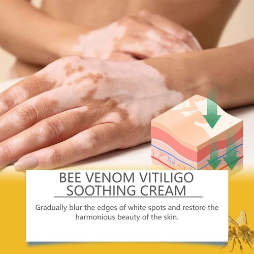 Don't miss out on today's exclusive offer! Get 3 bottles of Bee Venom Vitiligo Soothing Repair Cream at once. The core ingredients of bee venom deeply nourish the skin base, promote cell regeneration and enhance self-repairing ability. It gently acts on the affected areas, gradually blurring the edges of the spots and making the skin complexion even, with no side effects and providing peace of mind.it's a must-have for skin care.