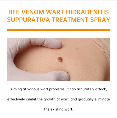 Tag Recede Bee Venom Treatment Spray, 20ML per bottle. Highly effective in removing various skin blemishes. Contains natural ingredients such as bee venom extract, safe and painless, without leaving scars. Place your order today and we will send you a total of 5 bottles. It can be used for about 3 months. Use it continuously to repair damage, deeply cleanse, and make the skin smooth again. Come and place your order now!