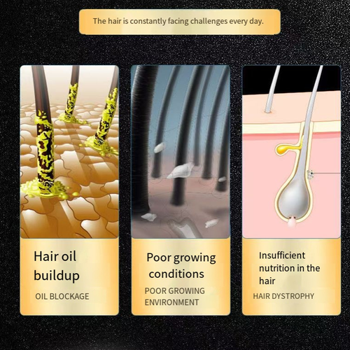 Order today and you will receive 2 bottles of White Hack Anti-Hair Loss Shampoo. It contains wolfberry + herbal extracts. After each use, it strengthens the hair roots, reduces hair loss and promotes thick hair growth. The foam is thick and can remove grease. Oily hair becomes soft and fluffy. After washing, the hair is moisturized and not frizzy. It is suitable for sensitive scalps and can be used without revealing the scalp when wearing a bun hairstyle.