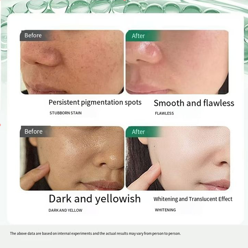 If you place the order today, we will send you a total of 5 bottles of high-potency molecular whitening and anti-spot essence spray. Just one spray can thoroughly clean your face. Its wide-angle nozzle can cover the entire face. It has the dual functions of lightening spots and brightening the skin tone. Even when you are bare-faced, it can still emit a natural glow. For those who are too lazy to put on makeup, this is a miracle skincare product.