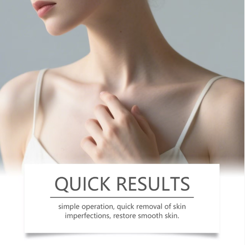 The Laniska plasma micro-discharge beauty care pen utilizes precise micro-energy technology to gently remove moles and blemishes, lighten warts and acne marks, without causing skin peeling. Even sensitive skin can be safely used. With a pen-like portable design, it is easy to operate and allows you to enjoy professional-level skin rejuvenation at home, effortlessly restoring a smooth and flawless complexion.