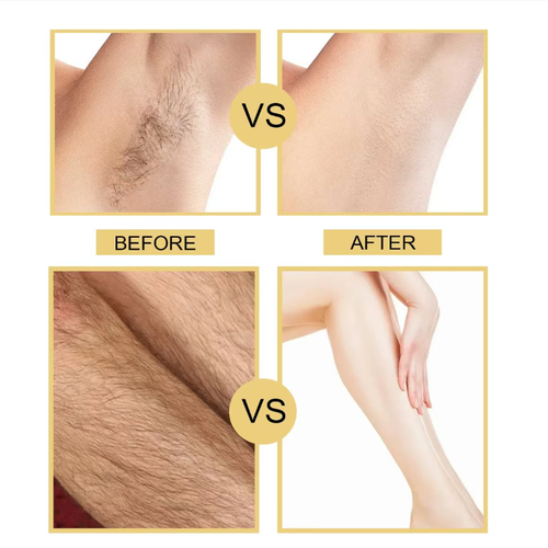 Order today and you will receive 3 boxes of the gentle, safe, non-irritating hair removal and dark spot fading intelligent revitalizing cream. The gentle revitalizing hair removal cream can remove hair from the roots in just 5 minutes without pain, leaving no residue. It contains aloe vera and vitamin E, which soothes and repairs, fades dark spots, is suitable for sensitive skin, and can be used all over the body.