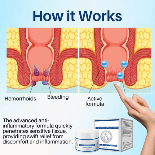Place your order today and you will receive 3 boxes of herbal anti-inflammatory mild and powerful hemorrhoid massage cream. It is gentle and non-irritating, can quickly relieve swelling, pain, bleeding and itching symptoms, and repair damaged mucous membranes. Its texture is fine, easy to absorb, convenient to use and hygienic. You can use it with confidence, get rid of discomfort, and enjoy relaxation and comfort.