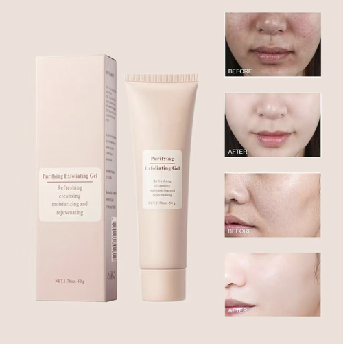 Place your order today and you will receive 5 boxes of the exfoliating and skin-repairing gel that removes melanin and reduces dullness. This refreshing and rejuvenating exfoliating gel can gently remove aging and dead skin cells, deeply cleanse the pores, and add moisturizing ingredients. After use, your skin will not feel tight, allowing you to say goodbye to dullness and roughness and regain a smooth, bright and delicate complexion.