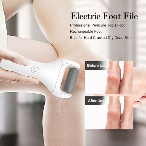Order today and you will receive 2 foot massagers. This electric foot massager is equipped with a diamond sand head, featuring two speed settings + gravity sensor adjustment. It is IPX7 level waterproof and easy to clean. It can be charged via USB and has a long battery life. It can quickly remove calluses and dead skin in just 3 minutes, allowing you to enjoy professional foot massage at home, saving time, effort and worry.