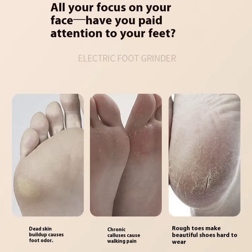 Charging electric foot and toe exfoliator, equipped with digital power display and multiple speed settings. The rotating grinding head removes calluses and dead skin cells from the sole of the foot. After softening the foot, gently polish it. Do not apply excessive pressure or stay for a long time. It cannot be used on damaged skin. The body must not be washed with water. If skin discomfort occurs, please stop using immediately.