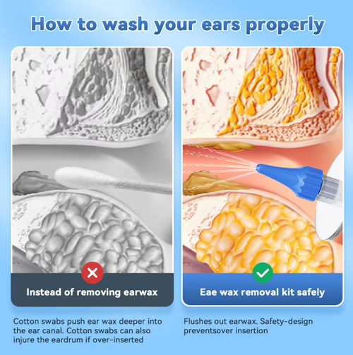 This household manual press-type ear cleaning device does not require electricity. It creates a gentle stream of water by pressing to clean the ear canal. The set includes a water storage bottle, a water collection container, multiple replaceable rinsing heads and a cleaning ear pick. The device is lightweight and portable. The accessories can be disassembled and washed for easy home use in cleaning the ear canal.
