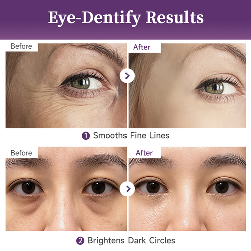 NAD+ Retinol Eye Cream 50 Peptides Anti-Wrinkle Eye Serum Reduce Dark Circles, Puffiness & Under Eye Bags for Youthful Eyes