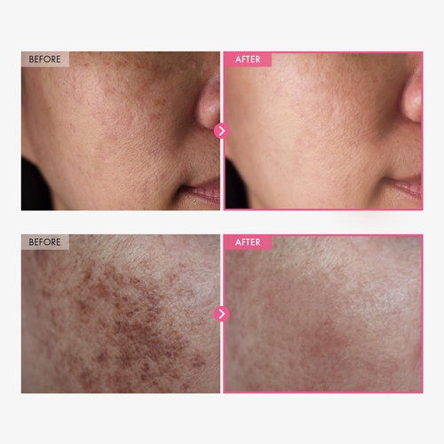 Face cream nicotinamide Reduces dark spots and freckles brightens the complexion Korean skincare cream