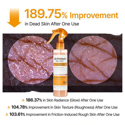 Kojic Acid Turmeric Exfoliating Spray 200ml | Body Keratin Care | Gentle Exfoliation | Leaves Skin Radiant