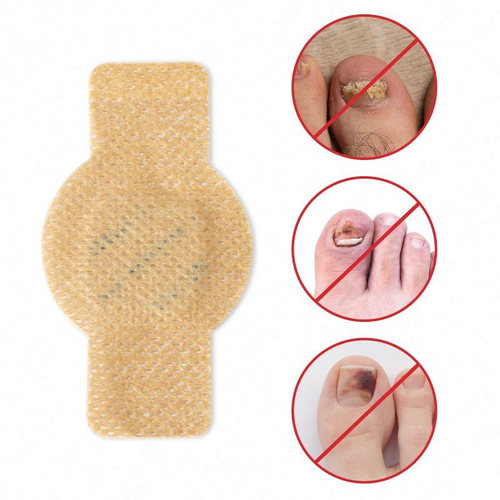 Nighttime Renewal Fungal Nail Treatment Patches Effortless Hydrogel Nail Care 8 Hours Fast Effective Nail Repair Patches  3X21=63Patches