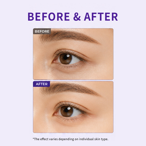 Anti Puffy Eye Cream 20ml, Each Box of Dark Circles Removing Moisturizing Anti Wrinkle Face Cream for Beauty and Skin Care Value 2-Pack