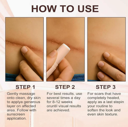 Moisturizing Scar Care Stick – Daily care balm to moisturize facial and body skin, smooth the appearance of scars, and soften the skin.