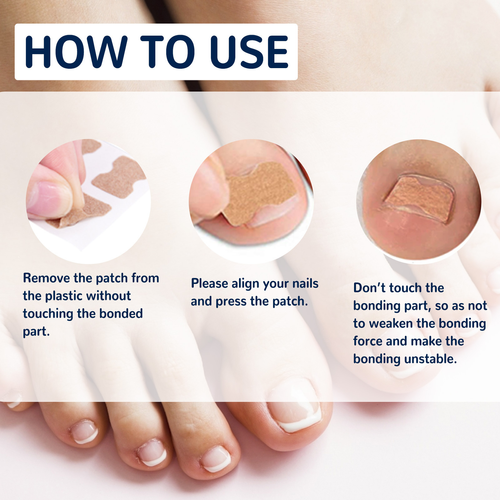 Nail Care: Gentle cleaning and protective patches for soft, ingrown, thickened, or fungal nails.