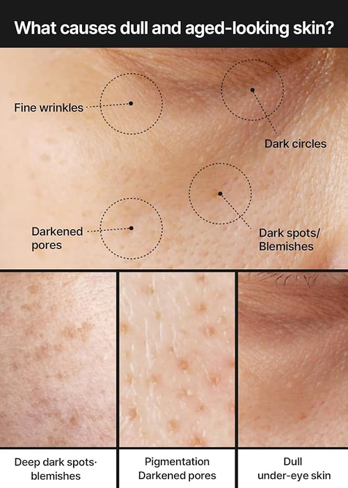 For Pore Minimizer Dark Spot Brightening Cream for Sensitive Skin Non-Irritating & Hydrating