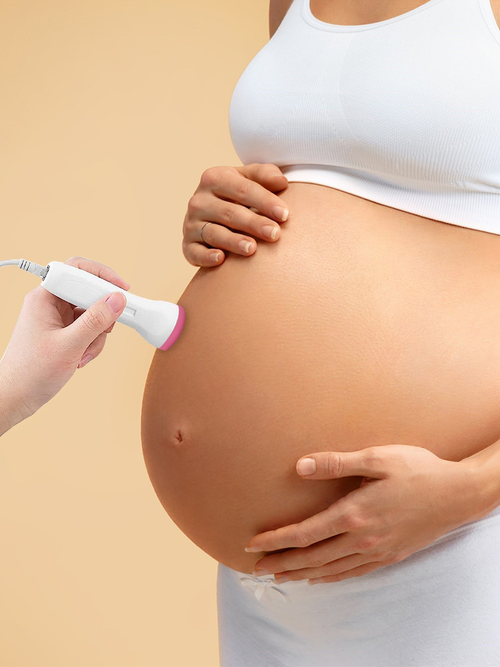 Fetal Doppler