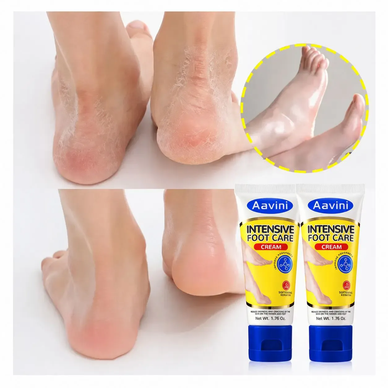 3PCS-Aavini Hand and Foot Moisture Hydrate