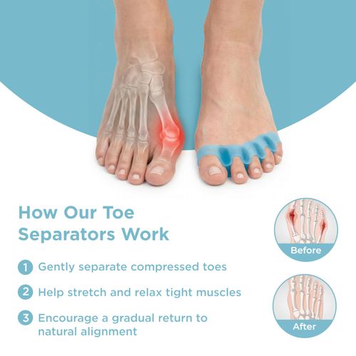 Toe Separators/Toe Spacers - Men & Women - Regular Size