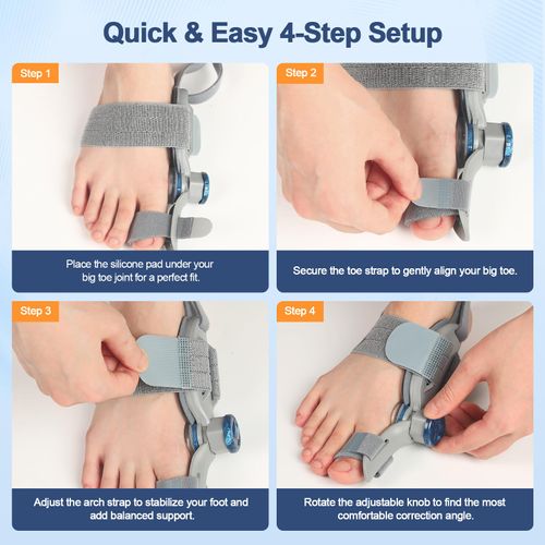Bunion Corrector for Women Men Big Toe,Adjustable Knob Bunion Corrector for Bunion Relief,Bunion Fix with Bunion Silicone Pad,Suitable for Left and Right Feet(1PCS)