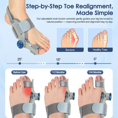 Bunion Corrector for Women Men Big Toe,Adjustable Knob Bunion Corrector for Bunion Relief,Bunion Fix with Bunion Silicone Pad,Suitable for Left and Right Feet(1PCS)
