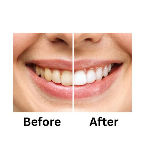 Natural Miswak Toothbrush Set, Teeth Cleaning Stick for Healthy Gums and Freshing Breath, Portable Natural Root Stick, Traditional Hand-Made Oral Care for Travel