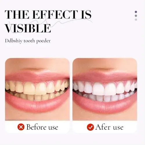 Tooth Whitening Powder