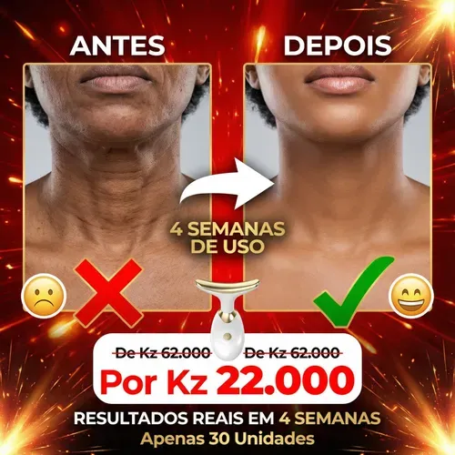 💕 Luanda 🇦🇴✨ — Aparelho EMS de Beleza Facial & Pescoço 💆‍♀️ — Lifting Natural em Casa 🏠 — Pele Mais Firme e Rejuvenescida Todos os Dias 💖