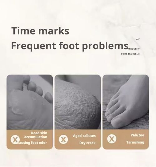 2192--Electric foot scrubber