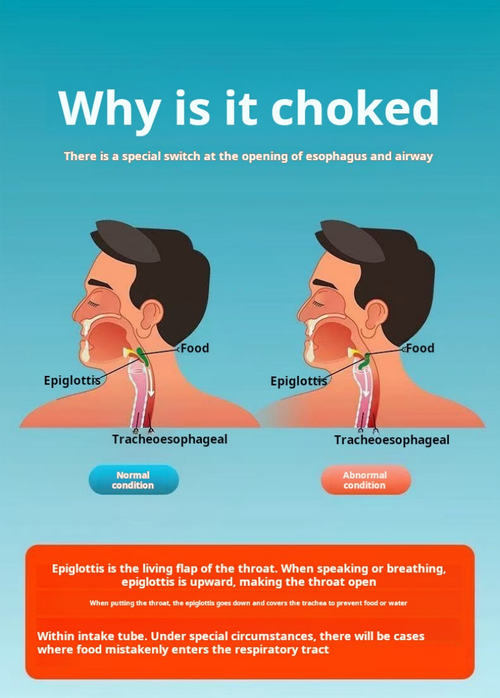 2137--Heimlich first aid device