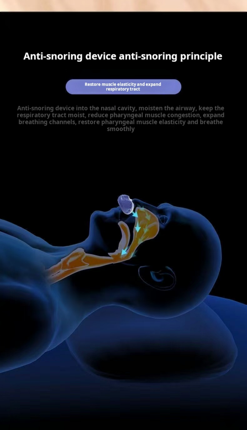 2130--Electric anti-snoring device