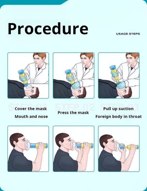 2137--Heimlich first aid device