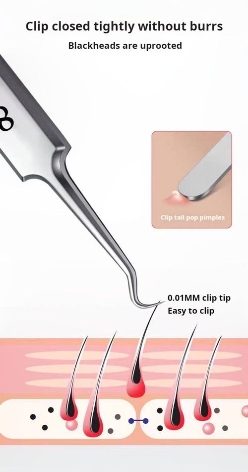 2427 - Six-piece set Blackhead and Pimple Removal Needle