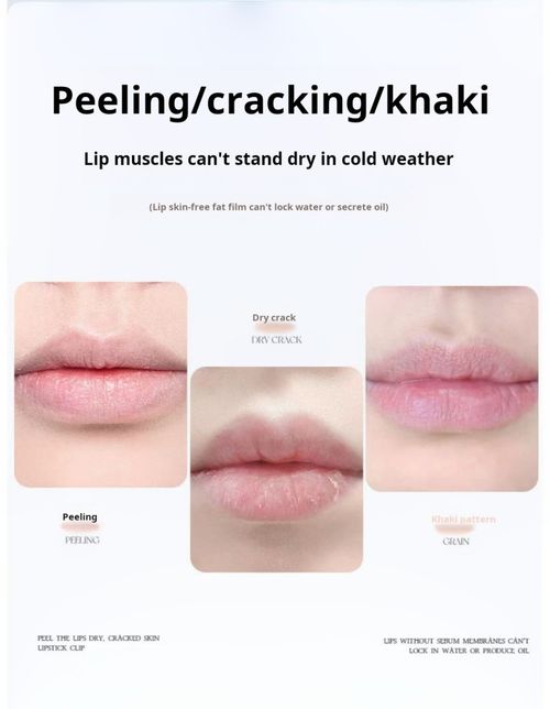 2353--3 Pieces Vitamin E Hyaluronic Acid Lip Balm