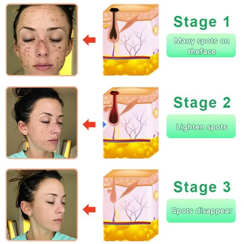 It is like giving your skin a thorough cleaning, absorbing deep-seated dirt, polishing and resurfacing, and instantly restoring clean matte skin.